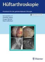 Cover von Hüftarthroskopie