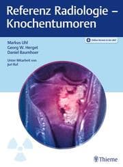 Cover von Referenz Radiologie - Knochentumoren