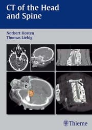 Cover von CT of the Head and Spine