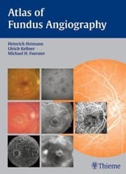 Cover von Atlas of Fundus Angiography