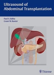 Cover von Ultrasound of Abdominal Transplantation