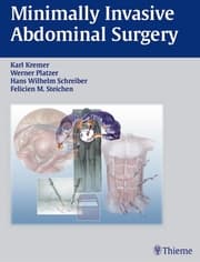 Cover von Minimally Invasive Abdominal Surgery