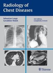 Cover von Radiology of Chest Diseases