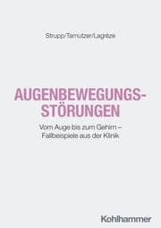 Cover von Augenbewegungsstörungen