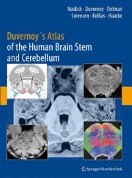 Cover von Duvernoy's Atlas of the Human Brain Stem and Cerebellum