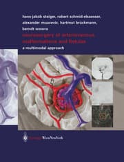 Cover von Neurosurgery of arteriovenous malformations and fistulas