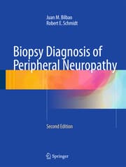 Cover von Biopsy Diagnosis of Peripheral Neuropathy