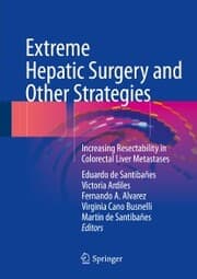 Cover von Extreme Hepatic Surgery and Other Strategies