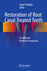 Cover von Restoration of Root Canal-Treated Teeth