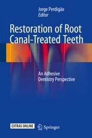 Cover von Restoration of Root Canal-Treated Teeth