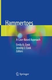 Cover von Hammertoes