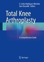 Cover von Total Knee Arthroplasty