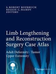 Cover von Limb Lengthening and Reconstruction Surgery Case Atlas