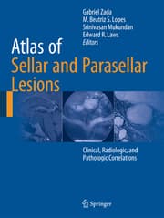 Cover von Atlas of Sellar and Parasellar Lesions