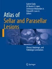 Cover von Atlas of Sellar and Parasellar Lesions