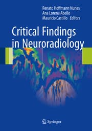 Cover von Critical Findings in Neuroradiology