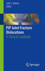 Cover von PIP Joint Fracture Dislocations