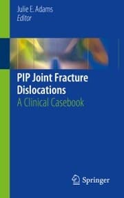 Cover von PIP Joint Fracture Dislocations