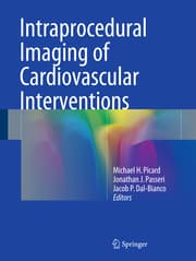 Cover von Intraprocedural Imaging of Cardiovascular Interventions