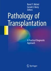 Cover von Pathology of Transplantation