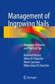 Cover von Management of Ingrowing Nails