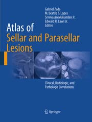 Cover von Atlas of Sellar and Parasellar Lesions