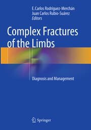 Cover von Complex Fractures of the Limbs