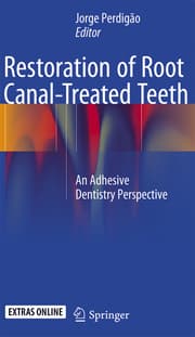 Cover von Restoration of Root Canal-Treated Teeth