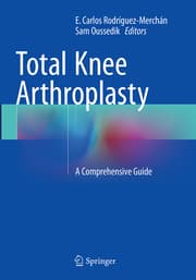 Cover von Total Knee Arthroplasty