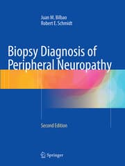 Cover von Biopsy Diagnosis of Peripheral Neuropathy