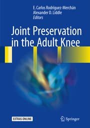 Cover von Joint Preservation in the Adult Knee