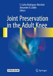 Cover von Joint Preservation in the Adult Knee
