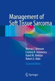 Cover von Management of Soft Tissue Sarcoma