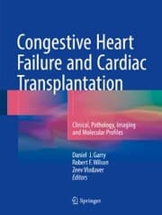 Cover von Congestive Heart Failure and Cardiac Transplantation