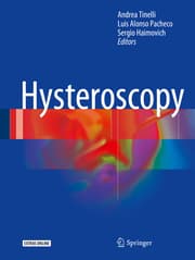 Cover von Hysteroscopy