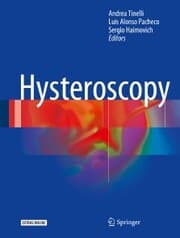 Cover von Hysteroscopy