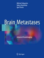 Cover von Brain Metastases