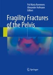 Cover von Fragility Fractures of the Pelvis