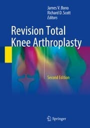 Cover von Revision Total Knee Arthroplasty