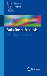 Cover von Early Onset Scoliosis