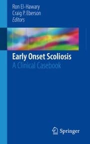 Cover von Early Onset Scoliosis
