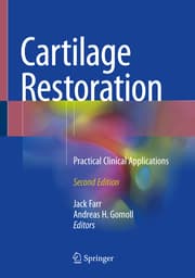 Cover von Cartilage Restoration