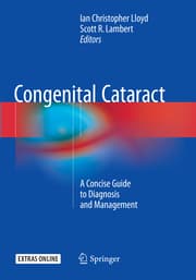 Cover von Congenital Cataract