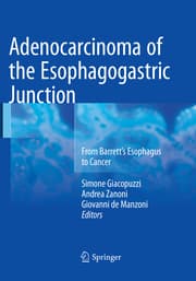 Cover von Adenocarcinoma of the Esophagogastric Junction