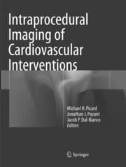 Cover von Intraprocedural Imaging of Cardiovascular Interventions