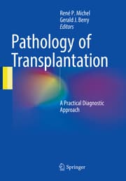 Cover von Pathology of Transplantation