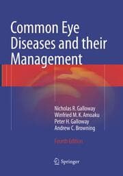 Cover von Common Eye Diseases and their Management