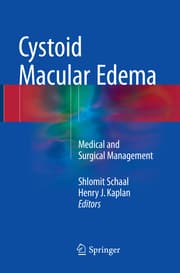 Cover von Cystoid Macular Edema