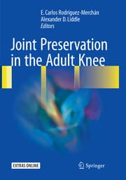 Cover von Joint Preservation in the Adult Knee