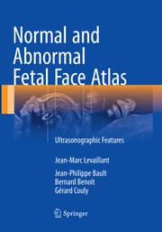 Cover von Normal and Abnormal Fetal Face Atlas